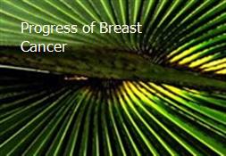 Progress of Breast Cancer Powerpoint Presentation