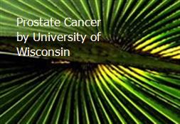 Prostate Cancer by University of Wisconsin Powerpoint Presentation