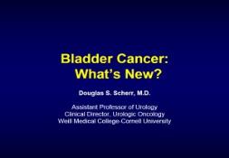 Management of Superficial Bladder Cancer PowerPoint Presentation