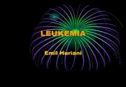 Askep Leukemia PowerPoint Presentation