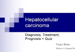 Liver cancer Hepatocellular carcinoma PowerPoint Presentation