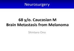 Brain Metastasis from Melanoma PowerPoint Presentation