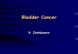 Bladder Cancer PowerPoint Presentation