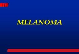 About MELANOMA Mednemo PowerPoint Presentation