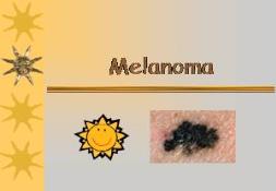 Melanoma (Riva Medical Care) PowerPoint Presentation