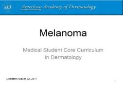 Melanoma PowerPoint Presentation