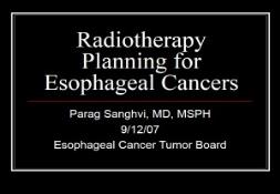 Radiotherapy Planning for Esophageal Cancers PowerPoint Presentation