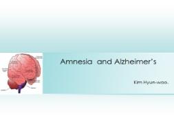 Amnesia and Alzheimer PowerPoint Presentation