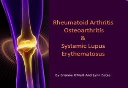 Introduction Rheumatoid Arthritis PowerPoint Presentation