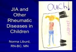 a Juvenile Rheumatoid Arthritis PowerPoint Presentation