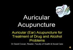 Auricular Acupuncture PowerPoint Presentation