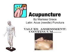 Desi Acupuncture PowerPoint Presentation