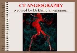 About CT ANGIOGRAPHY PowerPoint Presentation