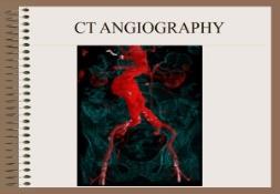 CT ANGIOGRAPHY PowerPoint Presentation