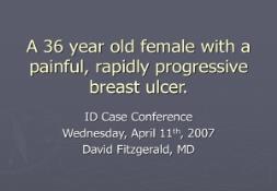 Breast abscess PowerPoint Presentation