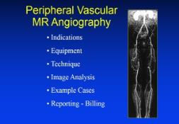 Peripheral Vascular MR Angiography PowerPoint Presentation