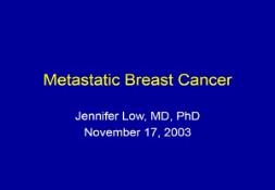 Metastatic Breast Cancer PowerPoint Presentation