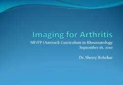 Imaging for Arthritis PowerPoint Presentation