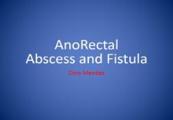 AnoRectal Abscess and Fistula PowerPoint Presentation