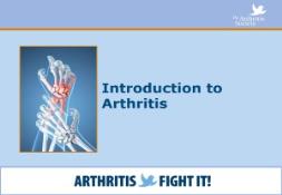 Introduction to Arthritis PowerPoint Presentation