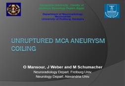 Unruptured MCA aneurysm coiling PowerPoint Presentation