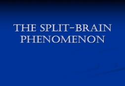 The Split brain Phenomena PowerPoint Presentation