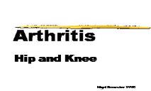 Arthritis PowerPoint Presentation