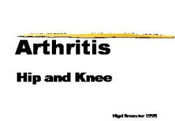 Arthritis PowerPoint Presentation