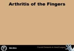 Arthritis of the Finger PowerPoint Presentation