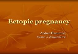 Ectopic Pregnancy Intro PowerPoint Presentation