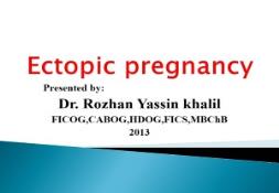 Ectopic pregnancy Slides PowerPoint Presentation