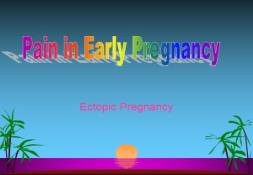 Ectopic Pregnancy PowerPoint Presentation