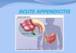 About ACUTE APPENDICITIS PowerPoint Presentation