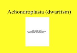 Achondroplasia (dwarfism) PowerPoint Presentation