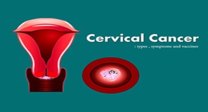 Free Download Cervical Cancer Prevention PowerPoint (PPT) Presentation