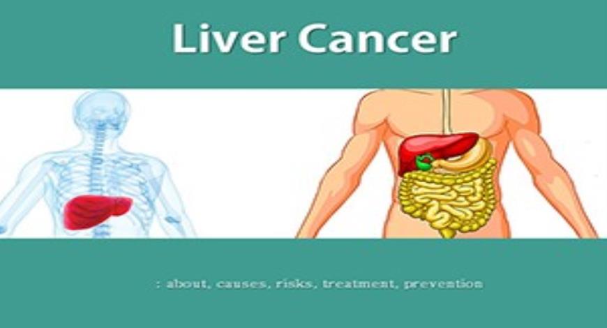 Free Download Liver Cancer Powerpoint Ppt Presentation Slidesfinder 