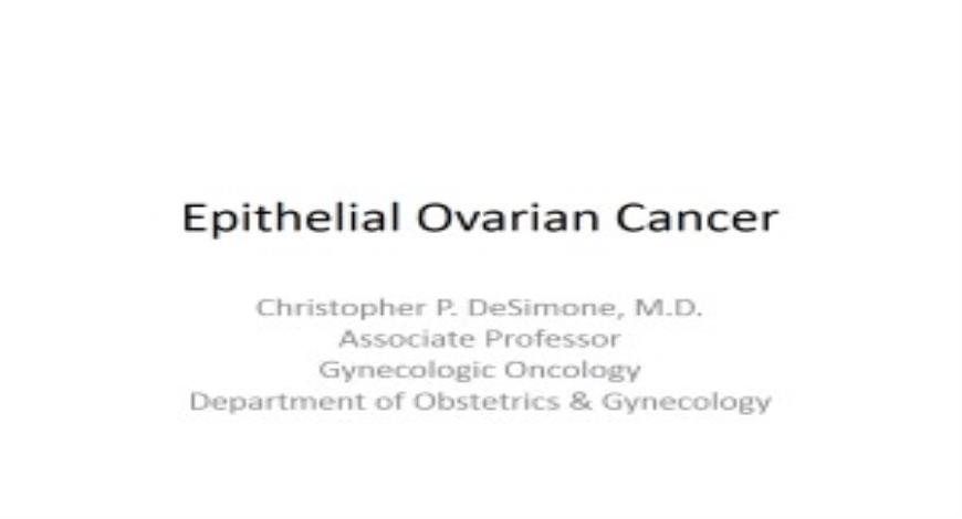 Free Download Introducation Of Ovarian Cancer Powerpoint Presentation 