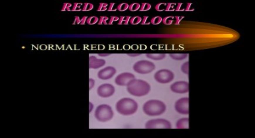 Free Download RED BLOOD CELL MORPHOLOGY PowerPoint Presentation Slides