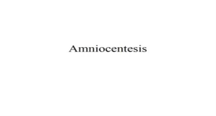 Free Download Amniocentesis PowerPoint Presentation Slides