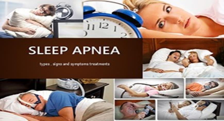 Free Download Sleep Apnea PowerPoint Presentation