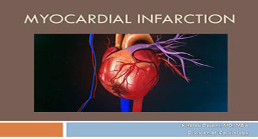 Free Download Myocardial Infarction PowerPoint Presentation ...