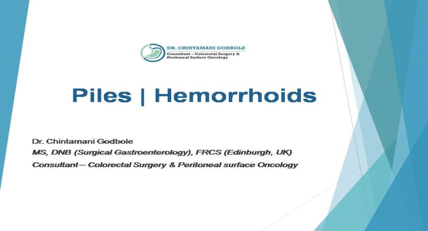 case study on hemorrhoids slideshare